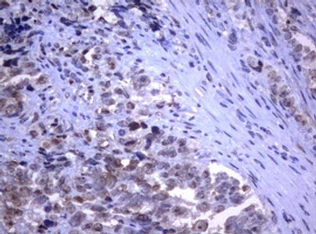 RASGRP3 Antibody in Immunohistochemistry (Paraffin) (IHC (P))