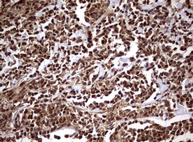 USP44 Antibody in Immunohistochemistry (Paraffin) (IHC (P))