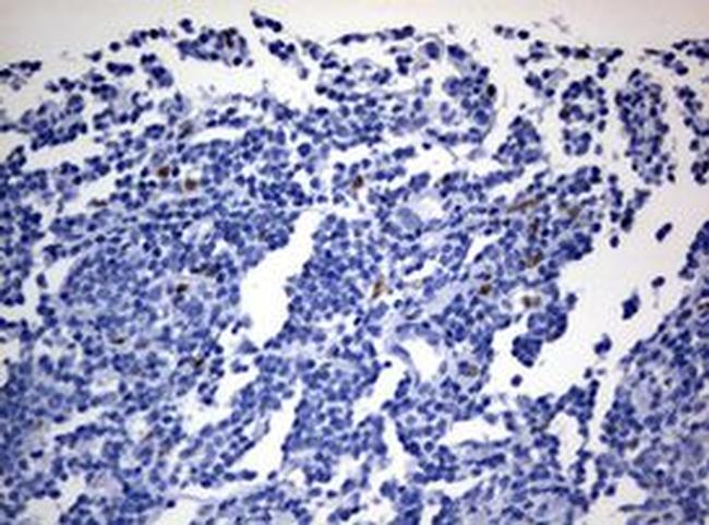 ZEB2 Antibody in Immunohistochemistry (Paraffin) (IHC (P))