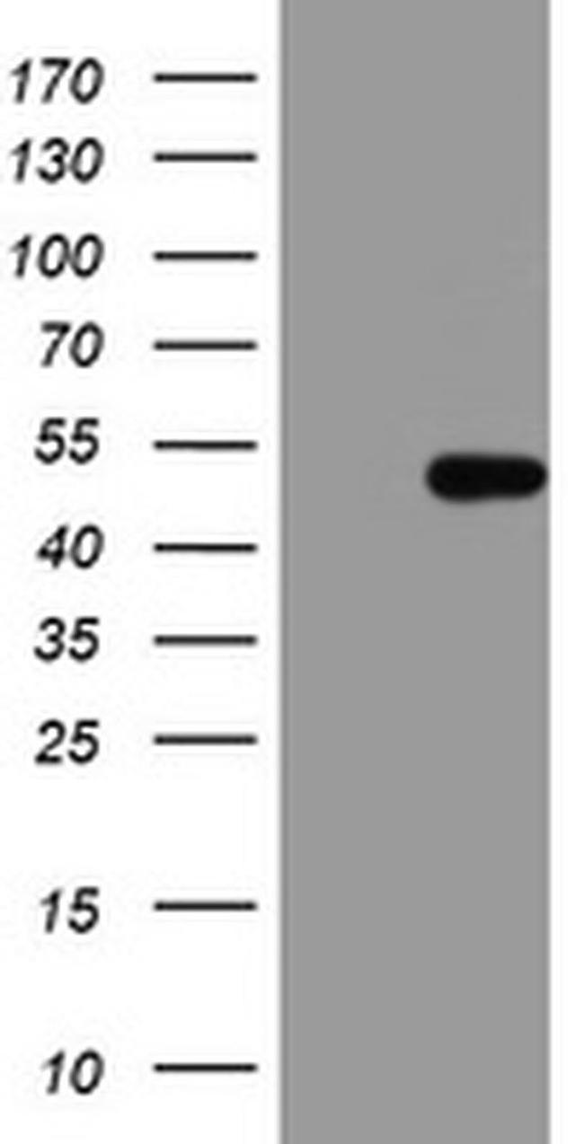 HMBS Antibody in Western Blot (WB)