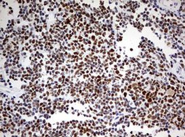 PARN Antibody in Immunohistochemistry (Paraffin) (IHC (P))