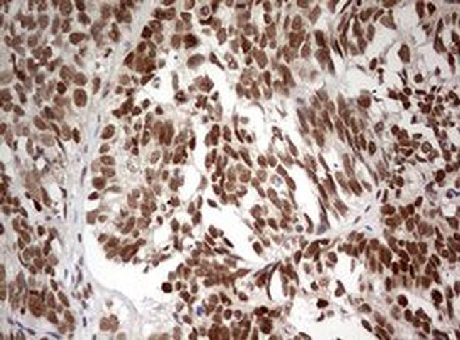 TRIM24 Antibody in Immunohistochemistry (Paraffin) (IHC (P))