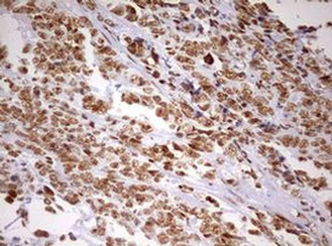 DDX56 Antibody in Immunohistochemistry (Paraffin) (IHC (P))