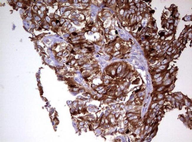 MRPS11 Antibody in Immunohistochemistry (Paraffin) (IHC (P))