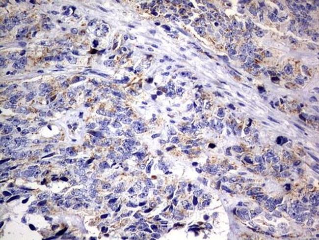 DAP3 Antibody in Immunohistochemistry (Paraffin) (IHC (P))