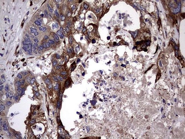 PLOD2 Antibody in Immunohistochemistry (Paraffin) (IHC (P))