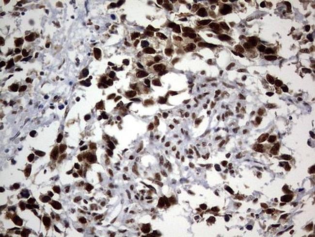 DDX56 Antibody in Immunohistochemistry (Paraffin) (IHC (P))