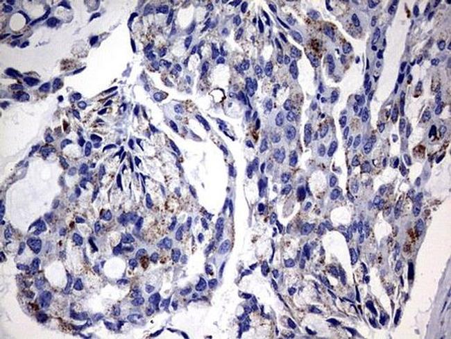 GBA Antibody in Immunohistochemistry (Paraffin) (IHC (P))