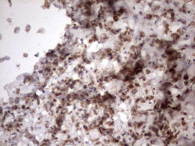 TR2 Antibody in Immunohistochemistry (Paraffin) (IHC (P))