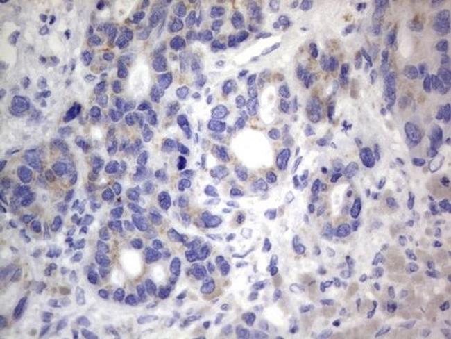 CHCHD3 Antibody in Immunohistochemistry (Paraffin) (IHC (P))