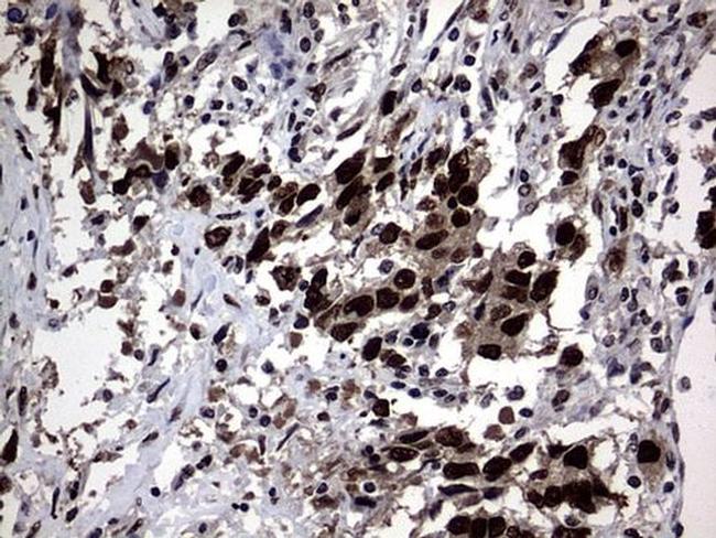 Macro H2A.2 Antibody in Immunohistochemistry (Paraffin) (IHC (P))