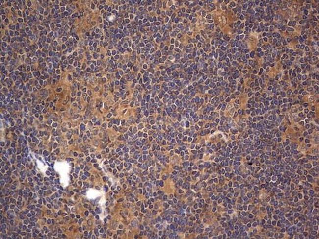 A-Raf Antibody in Immunohistochemistry (Paraffin) (IHC (P))