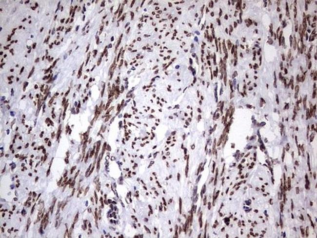 CK1 epsilon Antibody in Immunohistochemistry (Paraffin) (IHC (P))