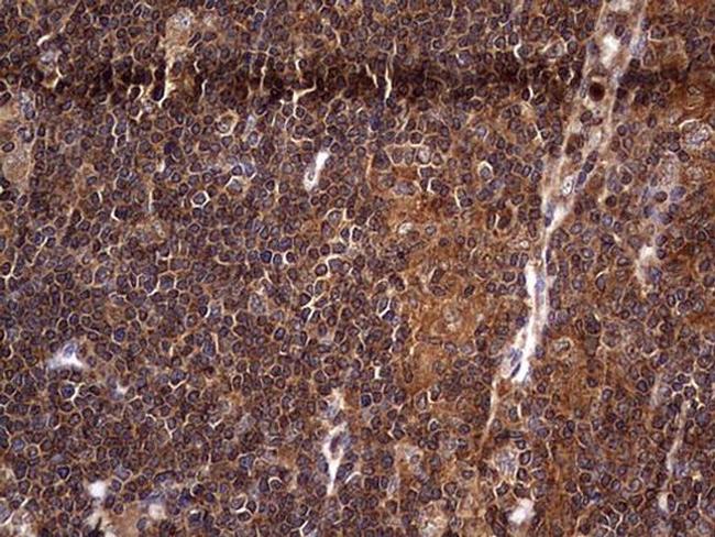 NRBF2 Antibody in Immunohistochemistry (Paraffin) (IHC (P))