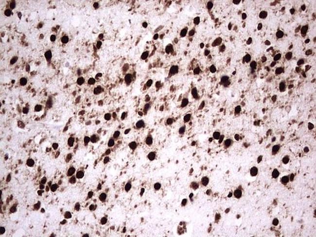 GLI1 Antibody in Immunohistochemistry (Paraffin) (IHC (P))