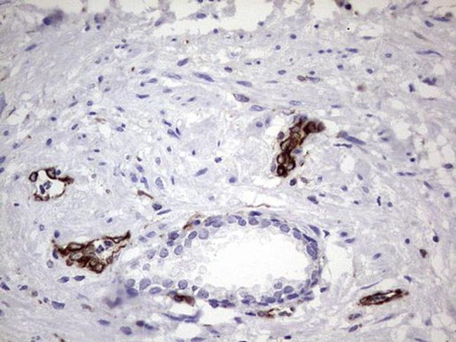 PPP2R5D Antibody in Immunohistochemistry (Paraffin) (IHC (P))