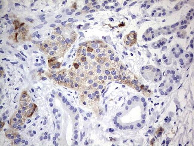 N4BP2L2 Antibody in Immunohistochemistry (Paraffin) (IHC (P))