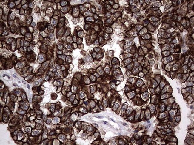 MIP-3 beta Antibody in Immunohistochemistry (Paraffin) (IHC (P))