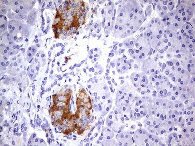 BFSP2 Antibody in Immunohistochemistry (Paraffin) (IHC (P))