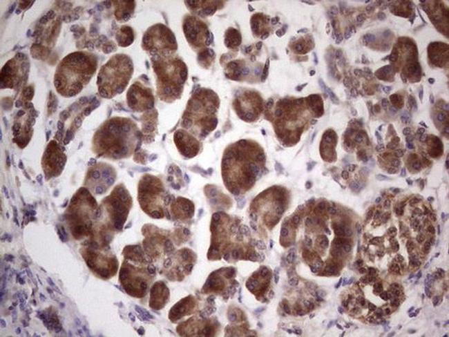 Centrin 1 Antibody in Immunohistochemistry (Paraffin) (IHC (P))