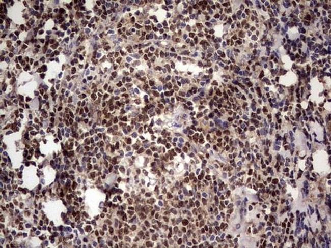 IKZF3 Antibody in Immunohistochemistry (Paraffin) (IHC (P))