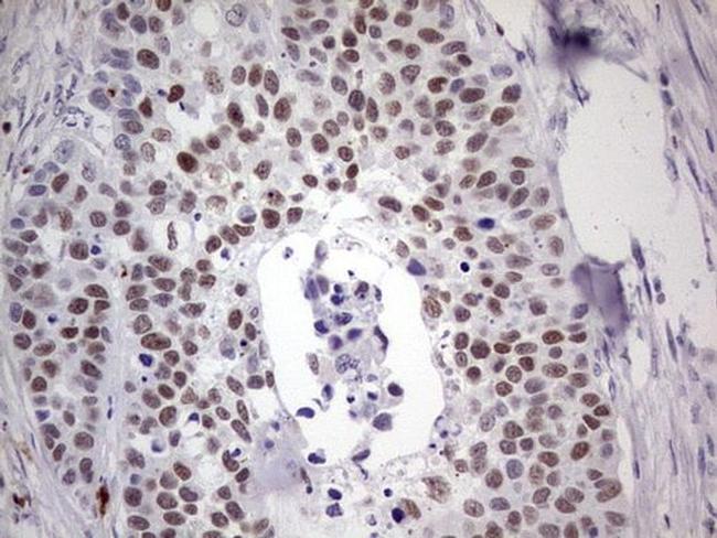 IKZF3 Antibody in Immunohistochemistry (Paraffin) (IHC (P))