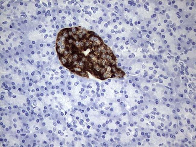 ADAMTS1 Antibody in Immunohistochemistry (Paraffin) (IHC (P))