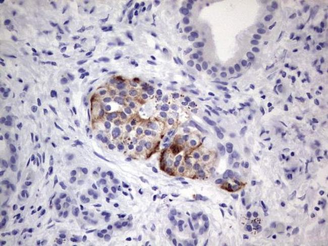 POMK Antibody in Immunohistochemistry (Paraffin) (IHC (P))