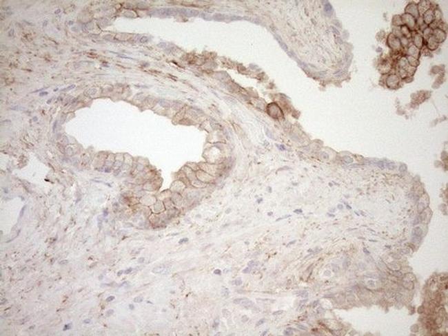 Calpain 5 Antibody in Immunohistochemistry (Paraffin) (IHC (P))