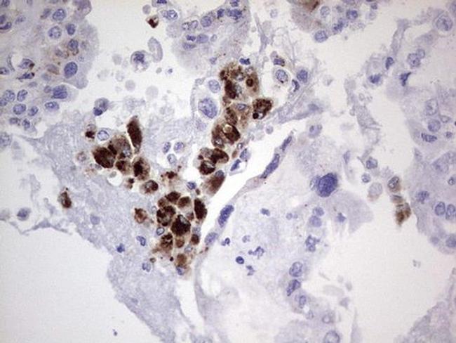 NOR-1 Antibody in Immunohistochemistry (Paraffin) (IHC (P))