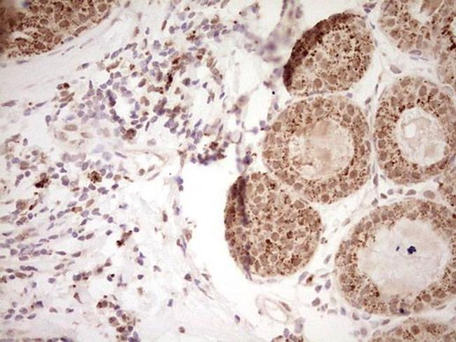 NOR-1 Antibody in Immunohistochemistry (Paraffin) (IHC (P))