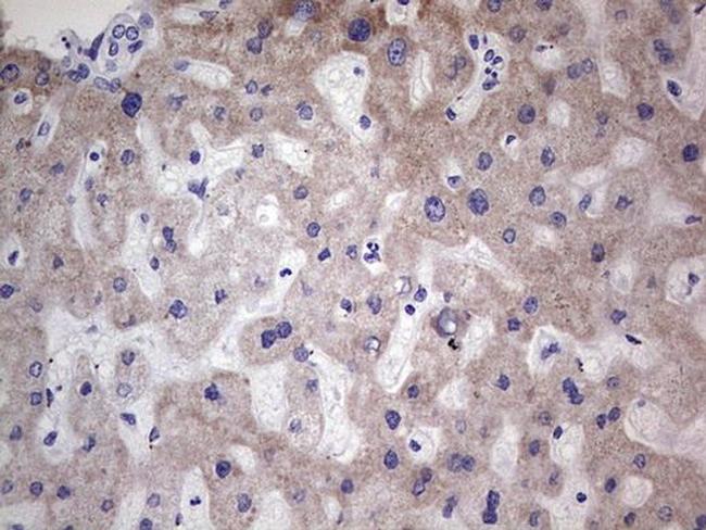 MB67 Antibody in Immunohistochemistry (Paraffin) (IHC (P))