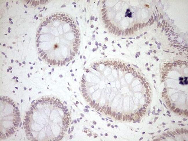 MB67 Antibody in Immunohistochemistry (Paraffin) (IHC (P))