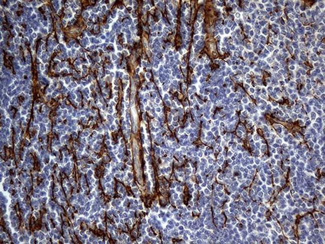 TGFBI Antibody in Immunohistochemistry (Paraffin) (IHC (P))