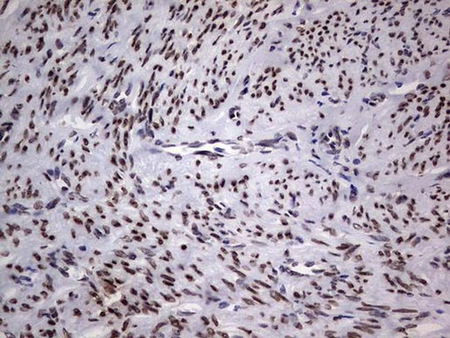 TLK2 Antibody in Immunohistochemistry (Paraffin) (IHC (P))