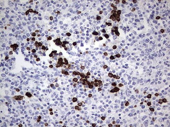 TLK2 Antibody in Immunohistochemistry (Paraffin) (IHC (P))