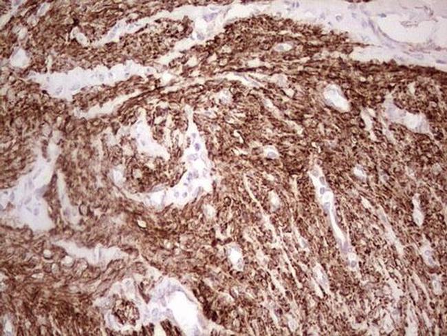 NFS1 Antibody in Immunohistochemistry (Paraffin) (IHC (P))