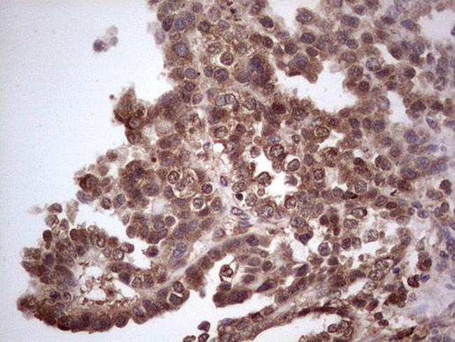 CDKL2 Antibody in Immunohistochemistry (Paraffin) (IHC (P))