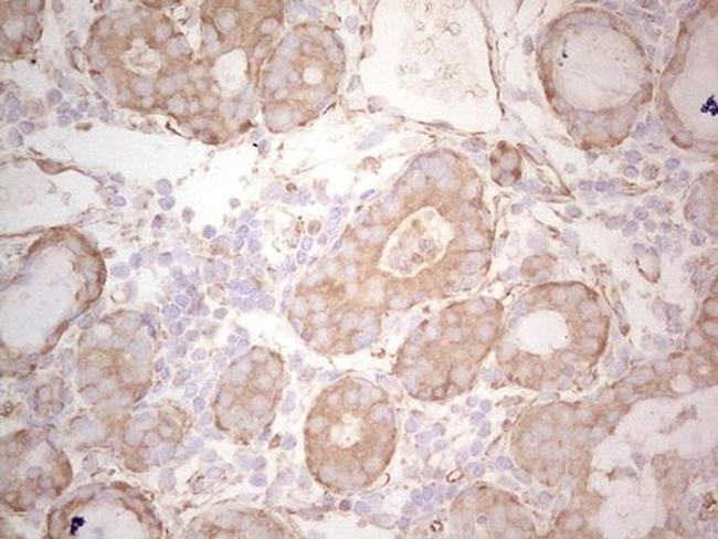 Ephrin A3 Antibody in Immunohistochemistry (Paraffin) (IHC (P))