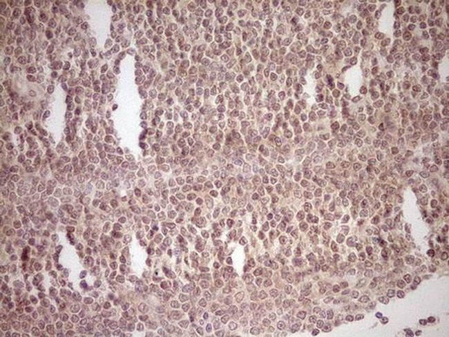 NR0B2 Antibody in Immunohistochemistry (Paraffin) (IHC (P))