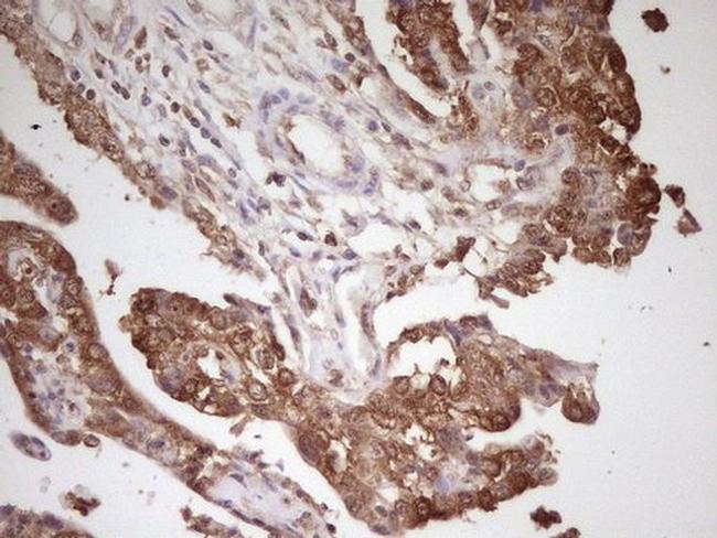 PCBP1 Antibody in Immunohistochemistry (Paraffin) (IHC (P))