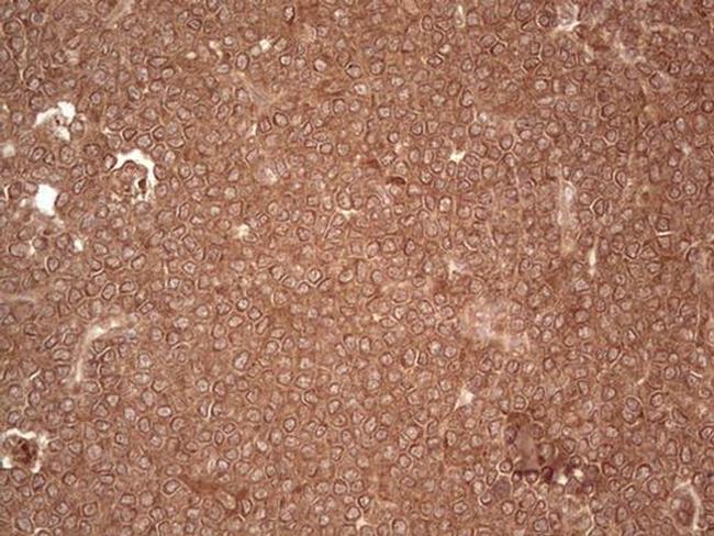 UBE2D2 Antibody in Immunohistochemistry (Paraffin) (IHC (P))