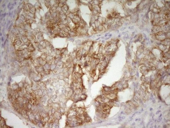 DVL2 Antibody in Immunohistochemistry (Paraffin) (IHC (P))