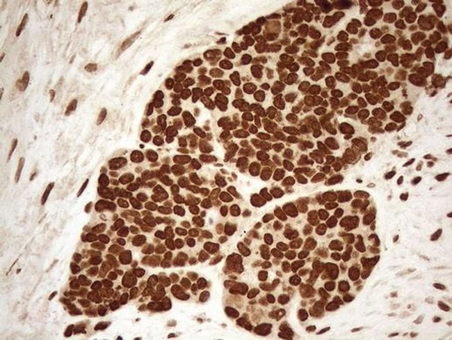 ALOX5 Antibody in Immunohistochemistry (Paraffin) (IHC (P))