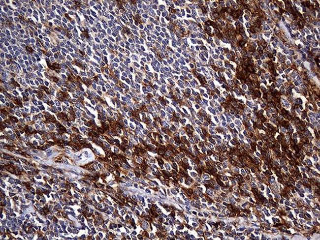 Carboxypeptidase M Antibody in Immunohistochemistry (Paraffin) (IHC (P))