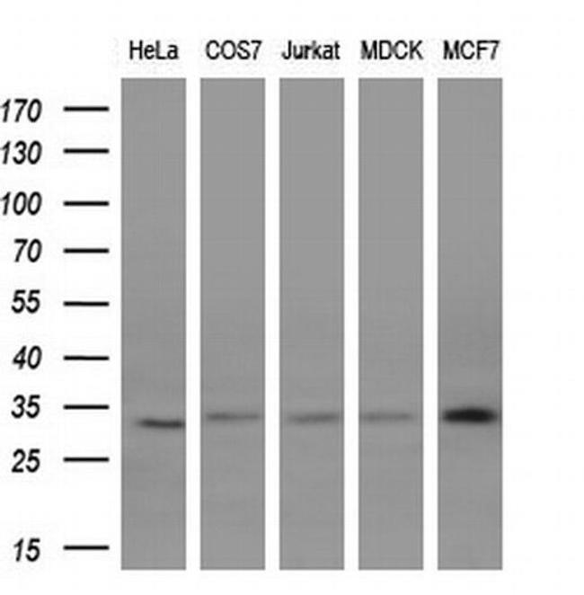 KChIP2 Antibody in Western Blot (WB)