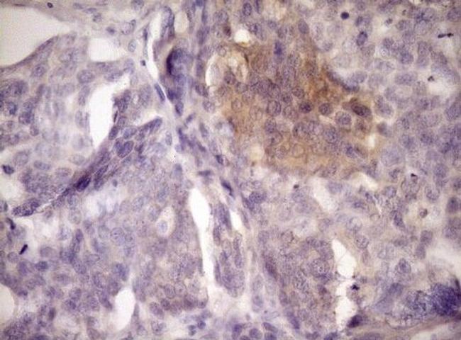 LOXL2 Antibody in Immunohistochemistry (Paraffin) (IHC (P))