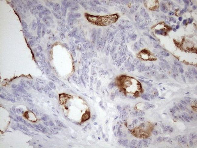 SSX2IP Antibody in Immunohistochemistry (Paraffin) (IHC (P))