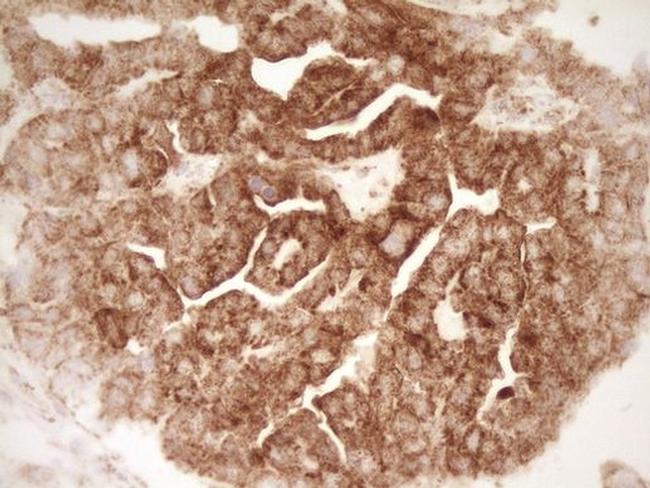 SFRP2 Antibody in Immunohistochemistry (Paraffin) (IHC (P))