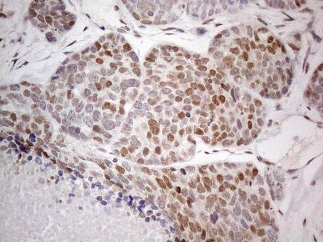 TCEAL1 Antibody in Immunohistochemistry (Paraffin) (IHC (P))